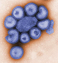 Vírus H1N1 da gripe suína